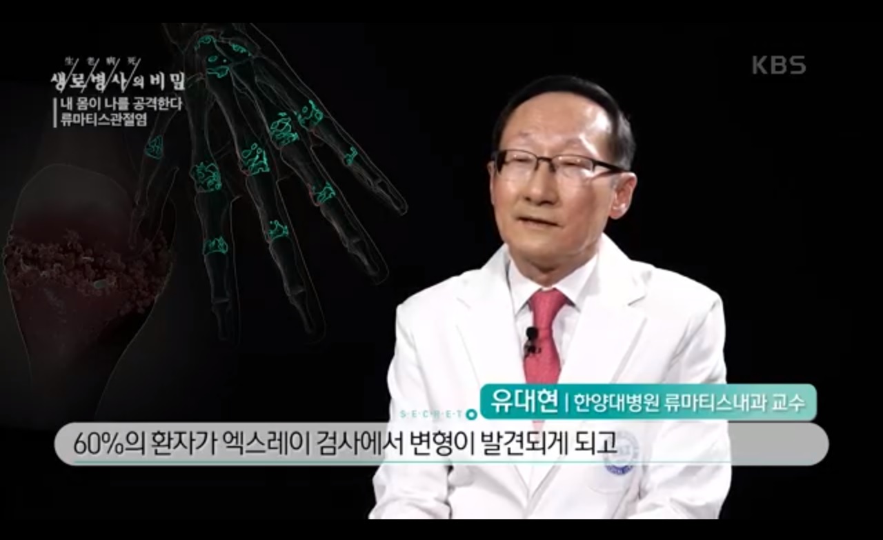 KBS 생로병사의 비밀_내 몸이 나를 공격한다, 류마티스관절염
